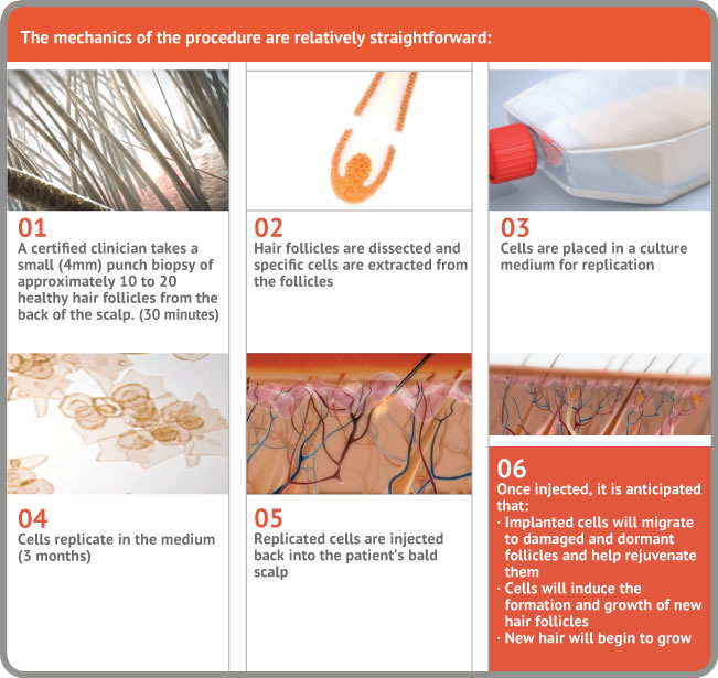 hair cell replacment